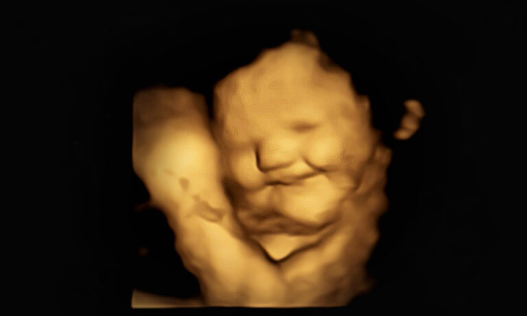 Selon une étude britannique, les bébés dans l&rsquo;utérus sourient lorsque leur mère mange des carottes, mais pleurent au goût du chou kale
