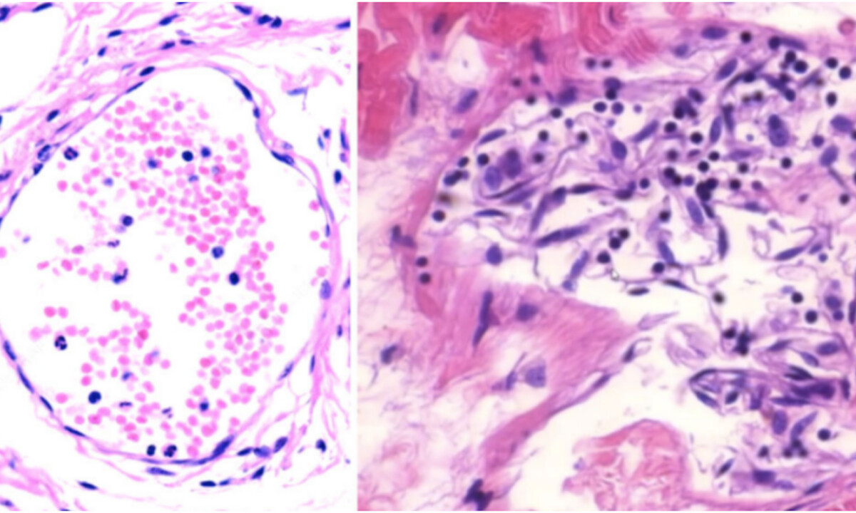 Étude avec «preuve irréfutable» sur les dommages des vaccins à ARNm: la réponse des médecins à l&rsquo;OMS