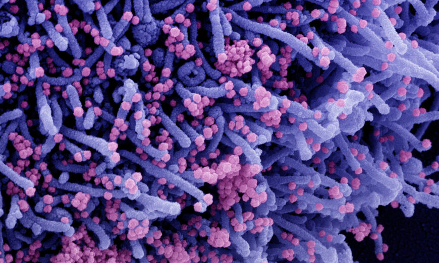 Une nouvelle étude démontre l&rsquo;existence d&rsquo;une immunité naturelle «de longue durée» contre le Covid-19