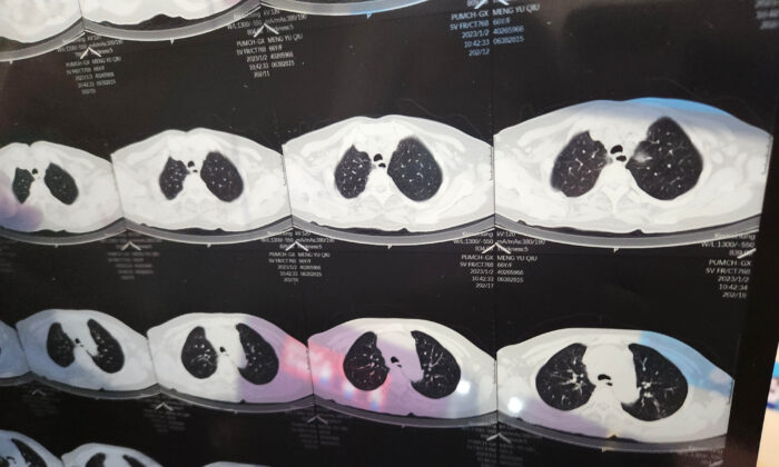 Covid en Chine: les témoignages sur les «poumons blancs» inondent les médias sociaux