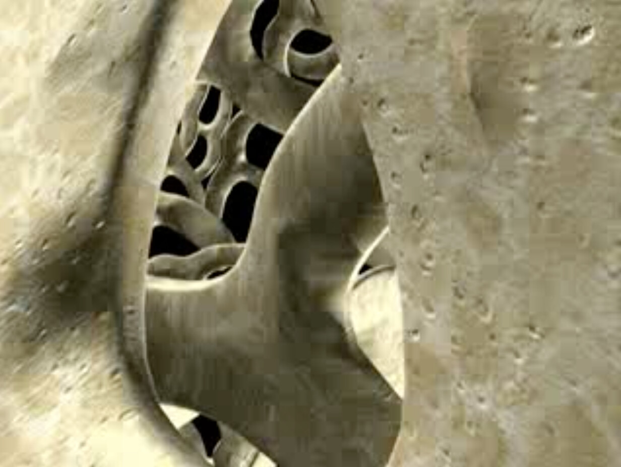 Ostéoporose masculine : un danger réel… et trop souvent sous-estimé