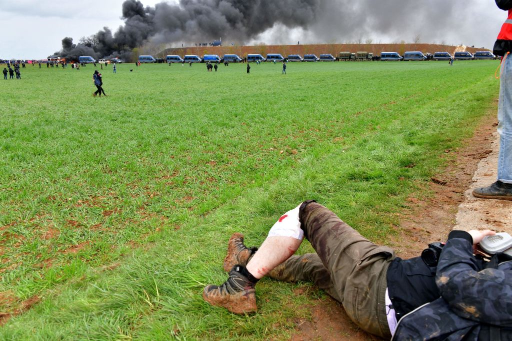 Sainte-Soline: l&rsquo;un des manifestants gravement blessés sort de l&rsquo;hôpital