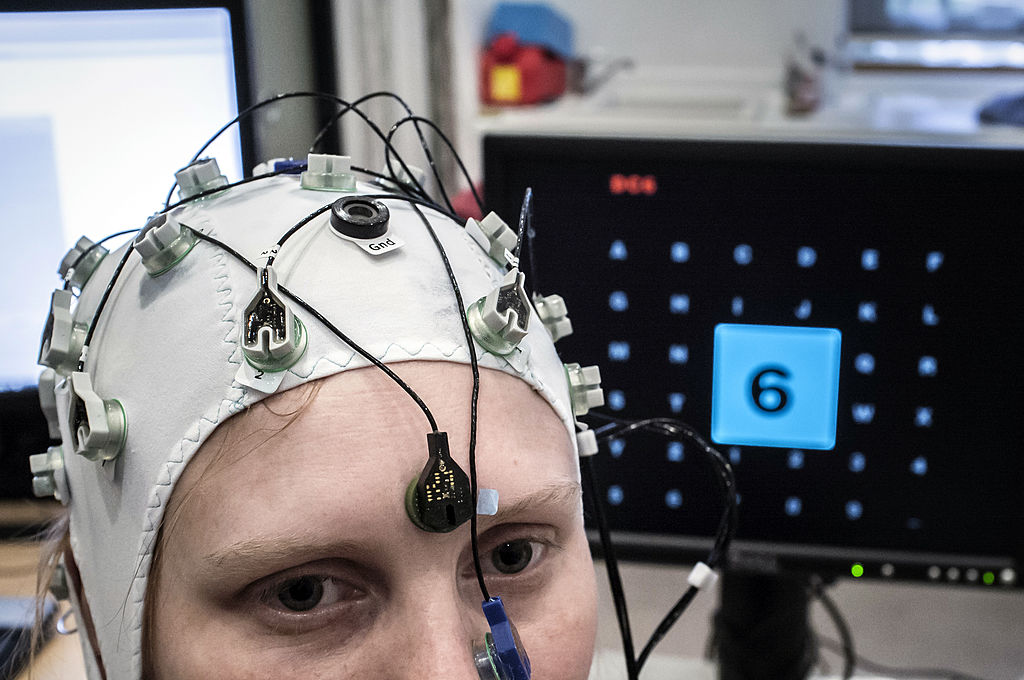 Mieux soigner l&rsquo;épilepsie, un défi difficile à relever