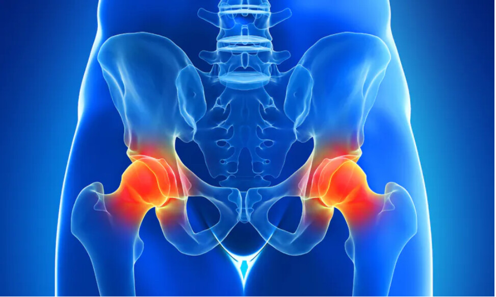 Douleur chronique de la hanche : les 5 meilleurs exercices (niveau facile) d&rsquo;un thérapeute