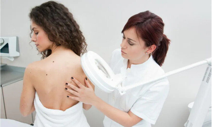 Ces 3 affections cutanées peuvent être des précurseurs du cancer