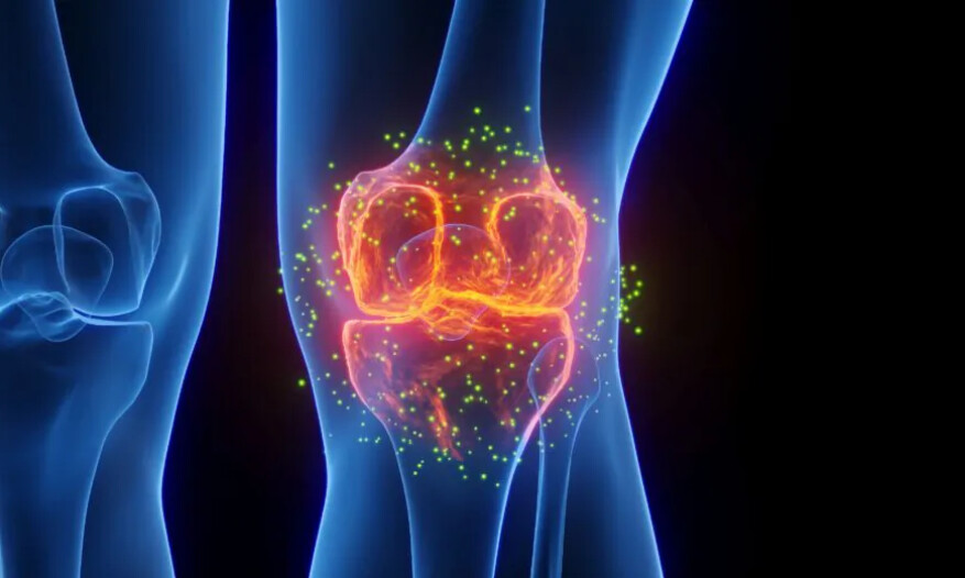 Douleur chronique du genou : 2e cause de douleur, 5 exercices faciles à faire à la maison pour soulager la douleur