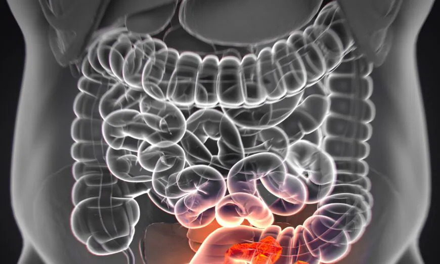 8 principaux facteurs de risque du cancer colorectal et 3 conseils pour préserver la santé digestive