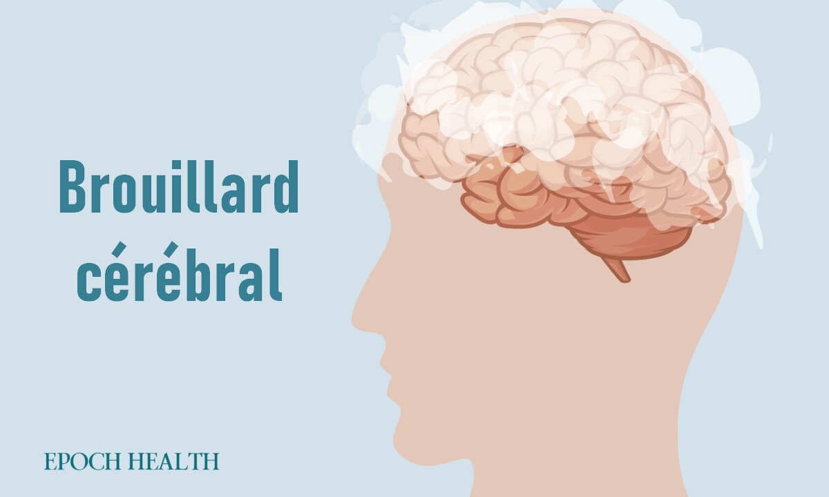 Le guide essentiel du brouillard cérébral : symptômes, causes, traitements et approches naturelles