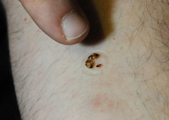 D’où proviennent les punaises de lit trouvées récemment dans des lieux publics ?