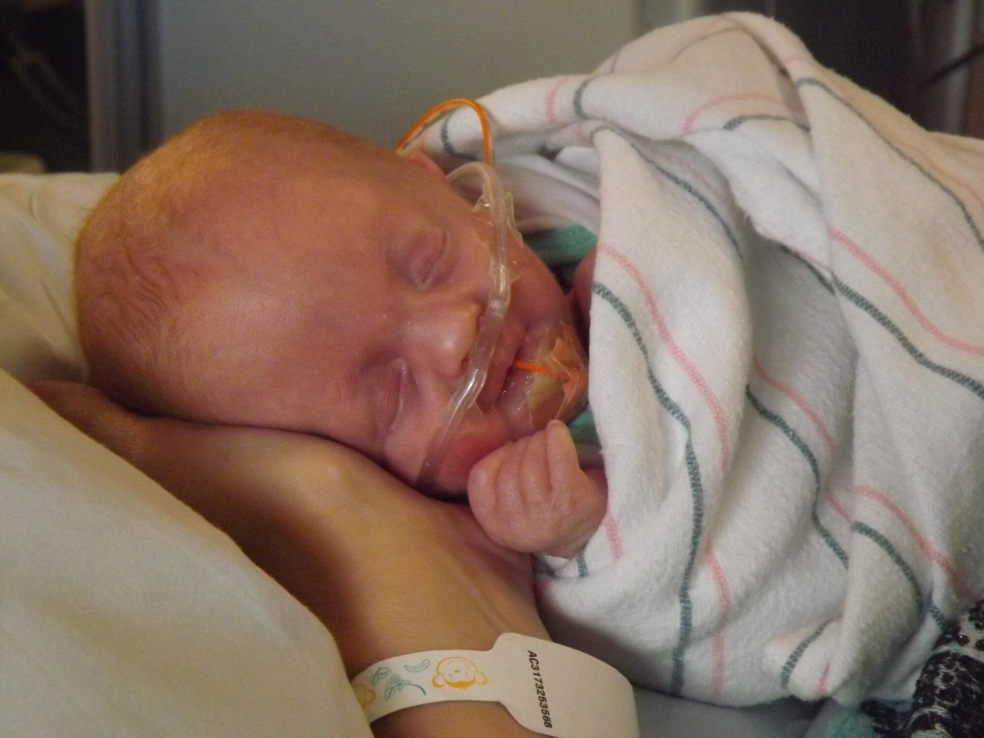 Les médecins qualifient un bébé atteint de trisomie 18 «d&rsquo;incompatible avec la vie» et proposent l&rsquo;avortement, mais le bébé continue à s&rsquo;épanouir: «Dieu ne commet pas d&rsquo;erreur»