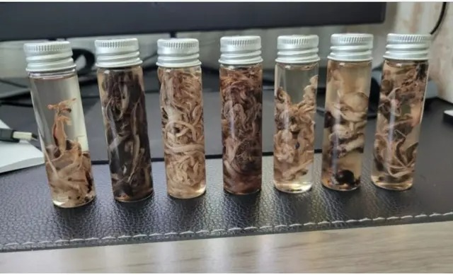 EXCLUSIF : Des embaumeurs s&rsquo;expriment sur des caillots sanguins inhabituels