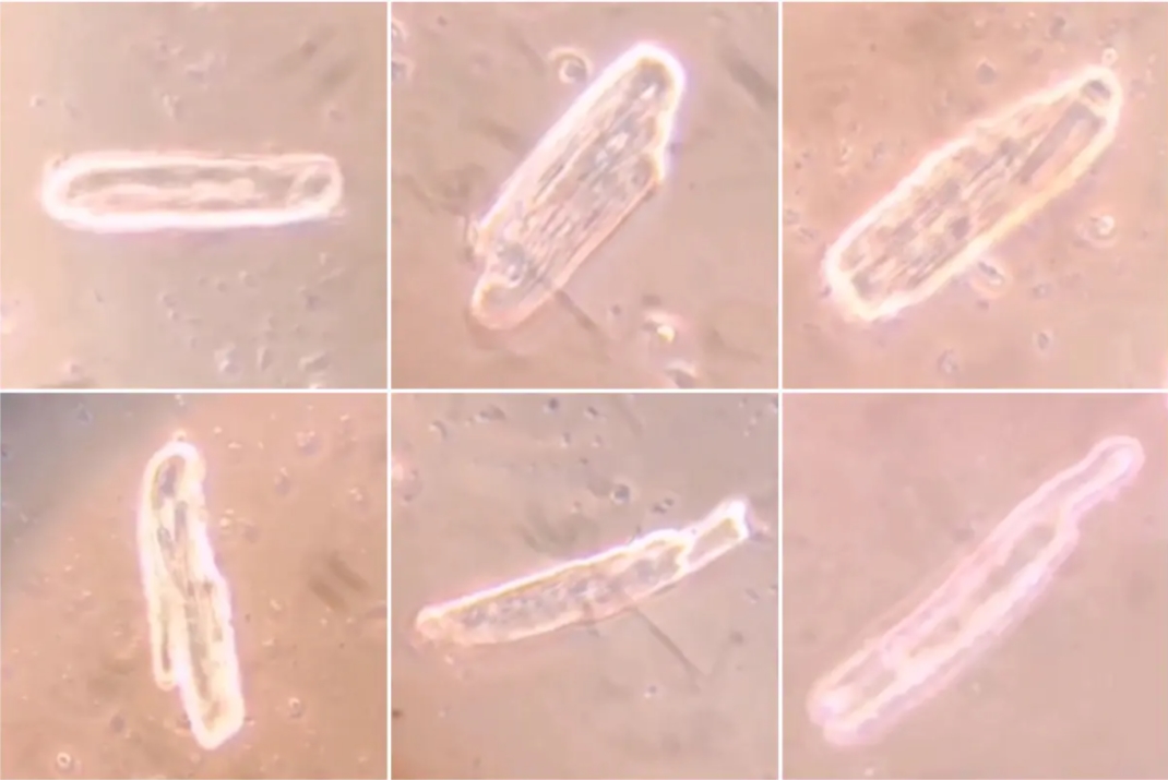 Les vaccins Covid à ARNm génèrent la protéine spike dans les cellules cardiaques mais entraînent différentes anomalies, selon de nouvelles recherches