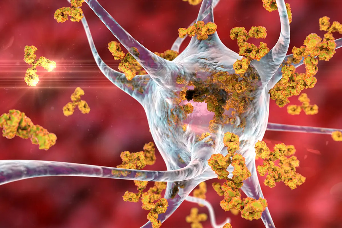 Le lien entre le sucre et les maladies auto-immunes