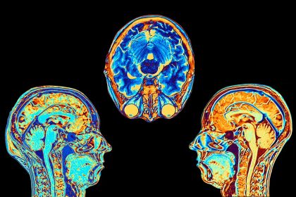 Ne rien faire: un «traitement» contre le cancer inattendu et potentiellement salvateur