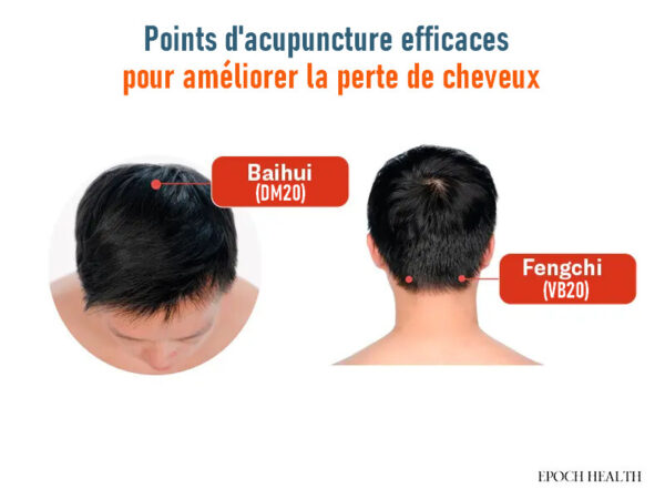 Six conseils pour favoriser des cheveux épais et denses : nutriments essentiels pour une croissance naturelle des cheveux