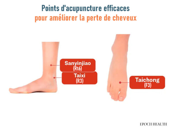 Six conseils pour favoriser des cheveux épais et denses : nutriments essentiels pour une croissance naturelle des cheveux