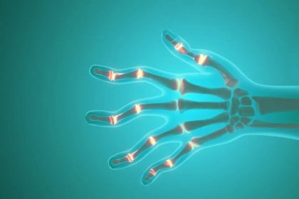 5 exercices recommandés par les thérapeutes pour gérer la polyarthrite rhumatoïde