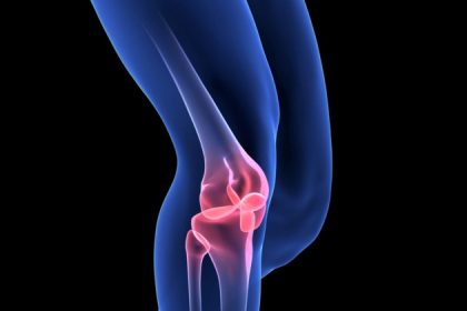 Un ligament croisé du genou peut guérir sans chirurgie