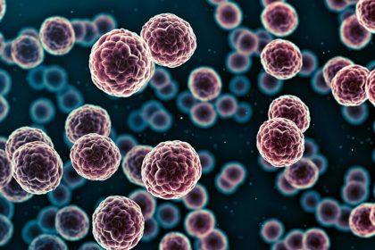 Un nombre record de cas de cancer est anticipé pour 2024 ; des experts expliquent les causes potentielles