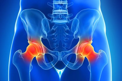 L&rsquo;arthrite soudaine : 6 exercices clés pour contrer l&rsquo;arthrite réactive