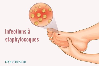 Le guide essentiel des infections à staphylocoques : symptômes, causes, traitements et approches naturelles