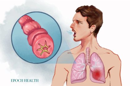 Le guide essentiel de l&rsquo;asthme : symptômes, causes, traitements et approches naturelles