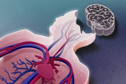 La mort cérébrale est-elle vraiment la mort?