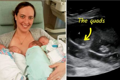 Une mère qui a perdu quatre enfants donne naissance à des quadruplés identiques : « J&rsquo;ai presque eu l&rsquo;impression que c&rsquo;était le destin »