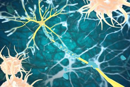 La stimulation lumineuse et sonore favorise la régénération de la « matière blanche » du cerveau et protège contre la neurodégénérescence