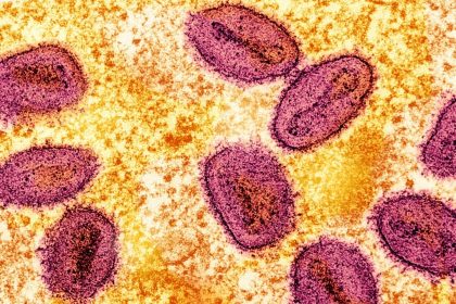 Le Mpox n&rsquo;est pas le nouveau Covid-19, il n&rsquo;y a pas lieu de procéder à des confinements, selon un responsable de l&rsquo;OMS