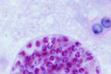 Le parasite peu connu qui infecte des millions de personnes chaque année