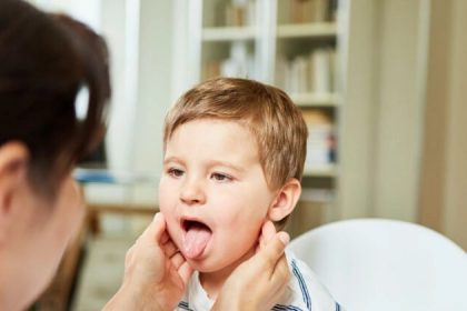 Les opérations chirurgicales de la langue chez les bébés sont en hausse