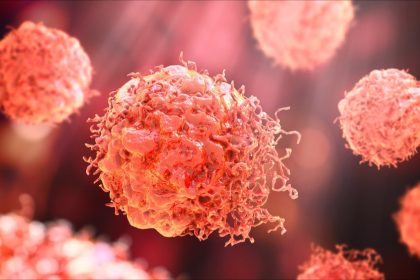 Cancer : des chercheurs français identifient des cellules immunitaires à l&rsquo;origine de la maladie