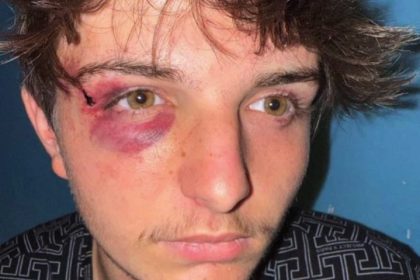 Agression homophobe à Mazamet : trois mineurs sont poursuivis parmi la dizaine d&rsquo;agresseurs