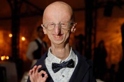 La lettre touchante que Sammy Basso, atteint de vieillissement prématuré, a écrite peu avant sa mort