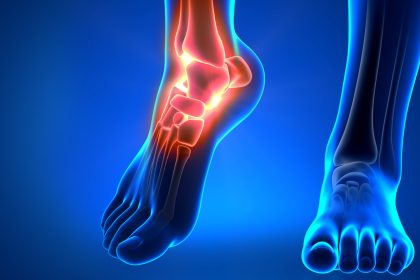 Douleur chronique de la cheville : souvent causée par une faiblesse de la cheville, voici cinq exercices pour la renforcer et prévenir les blessures