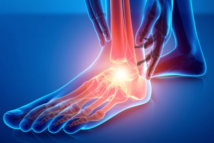 Douleur chronique du pied : deux causes courantes et cinq exercices faciles pour la soulager