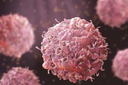 Les aliments ultratransformés entravent le processus de guérison de l&rsquo;organisme et favorisent la croissance du cancer colorectal