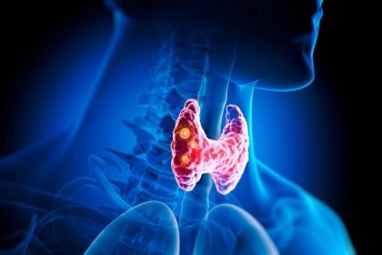 Troubles de la thyroïde : remèdes naturels et options de traitement