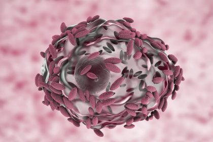 La vaginose bactérienne, qui touche une femme sur trois, pourrait être une IST