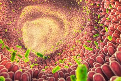 Hyperperméabilité intestinale – une des maladies les plus mystérieuses : peut-on la prévenir ?