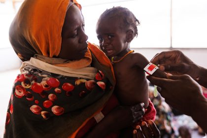 La malnutrition aiguë s&rsquo;étend dans le monde, sombres perspectives pour 2025