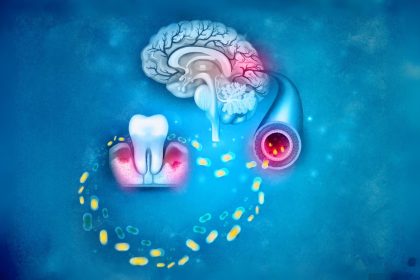 Comment la santé bucco-dentaire pourrait influencer le déclin cognitif