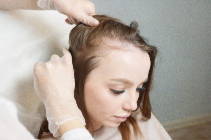 Comment les femmes peuvent prévenir la perte de cheveux en nourrissant le foie et les reins