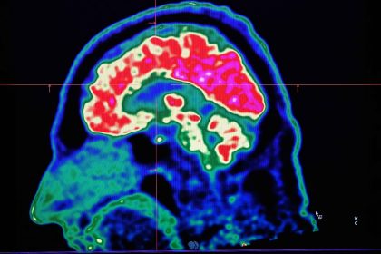 Microplastiques et cerveau : des risques à surveiller