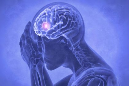 Lien méconnu entre micro-AVC et fatigue persistante