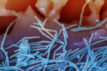 Efficacité du vaccin contre le VRS en baisse chez les seniors