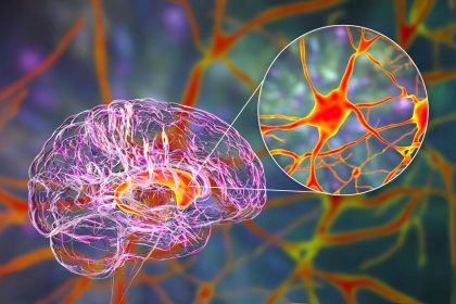 Comment le traitement du sucre par le cerveau pourrait influencer le risque de la maladie d’Alzheimer