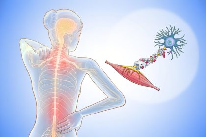 Sclérose en plaques : reconnaître les signes précoces