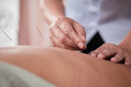 Et si l’acupuncture était la clé contre le mal de dos chronique ?